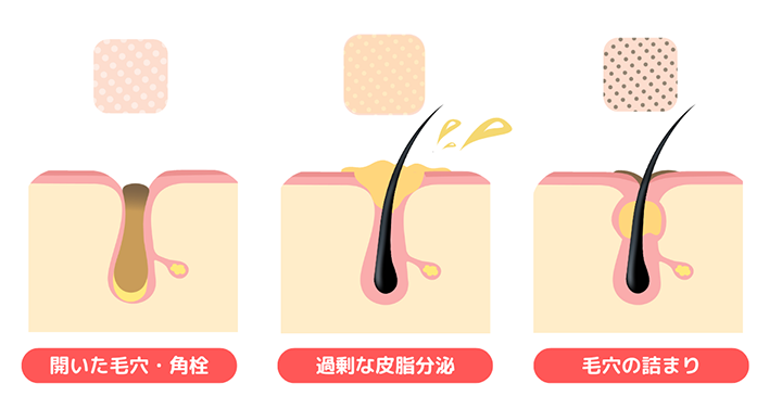 画像：顔を触って悩んでいる女性の画像