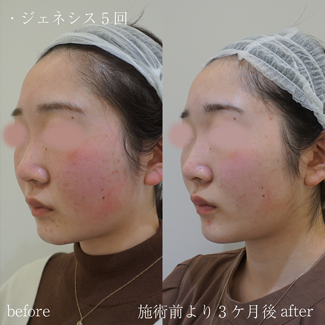 画像：実際にドクターズコスメで治療を受けた患者様の症例画像