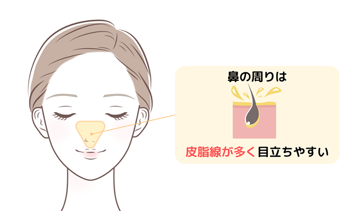 イラスト:鼻の皮脂