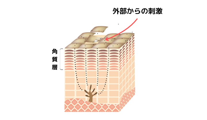 画像:肌断面図