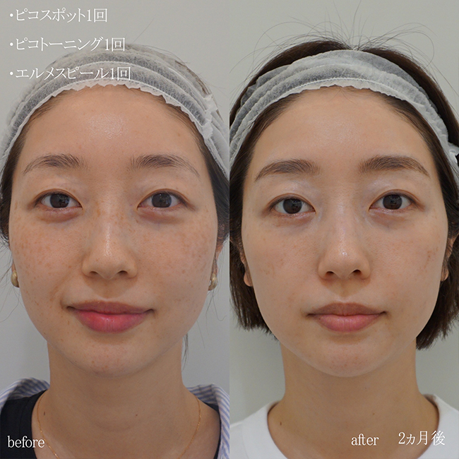 画像：実際にドクターズコスメで治療を受けた患者様の症例画像