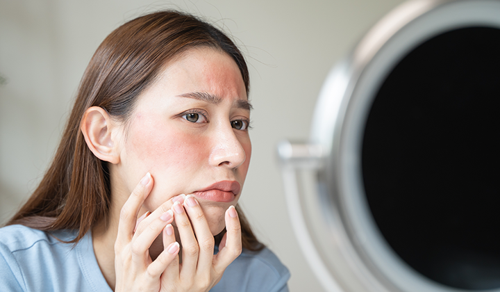 画像：顔を気にする女性