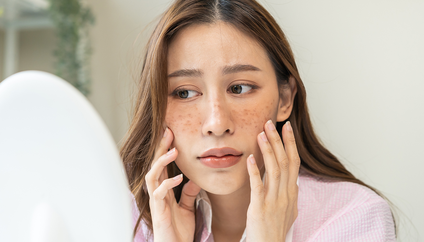 画像:鏡でしみやそばかすを気にする女性