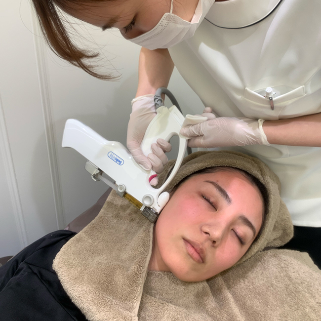 画像：水光注射画像