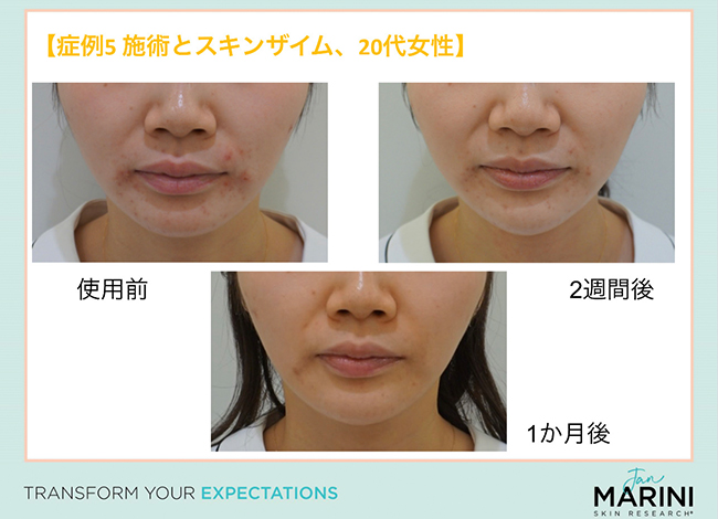 画像：ドクターズコスメの使用