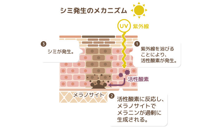 イラスト:シミ発生のメカニズム