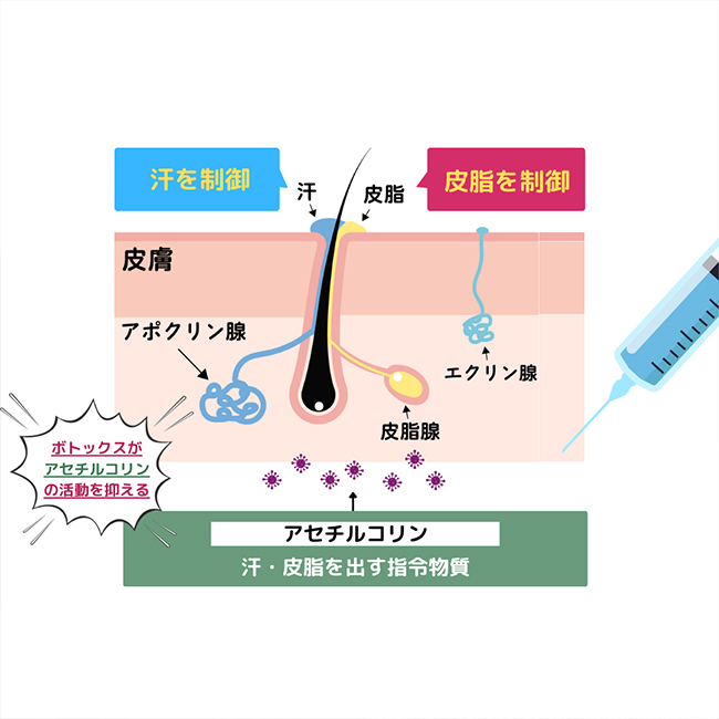 画像:マイクロボトックス施術画像